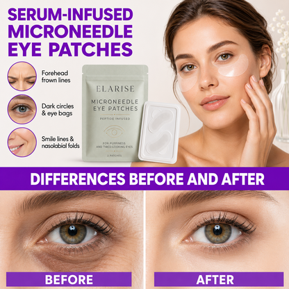 Dissolving Microneedle Eye Patches