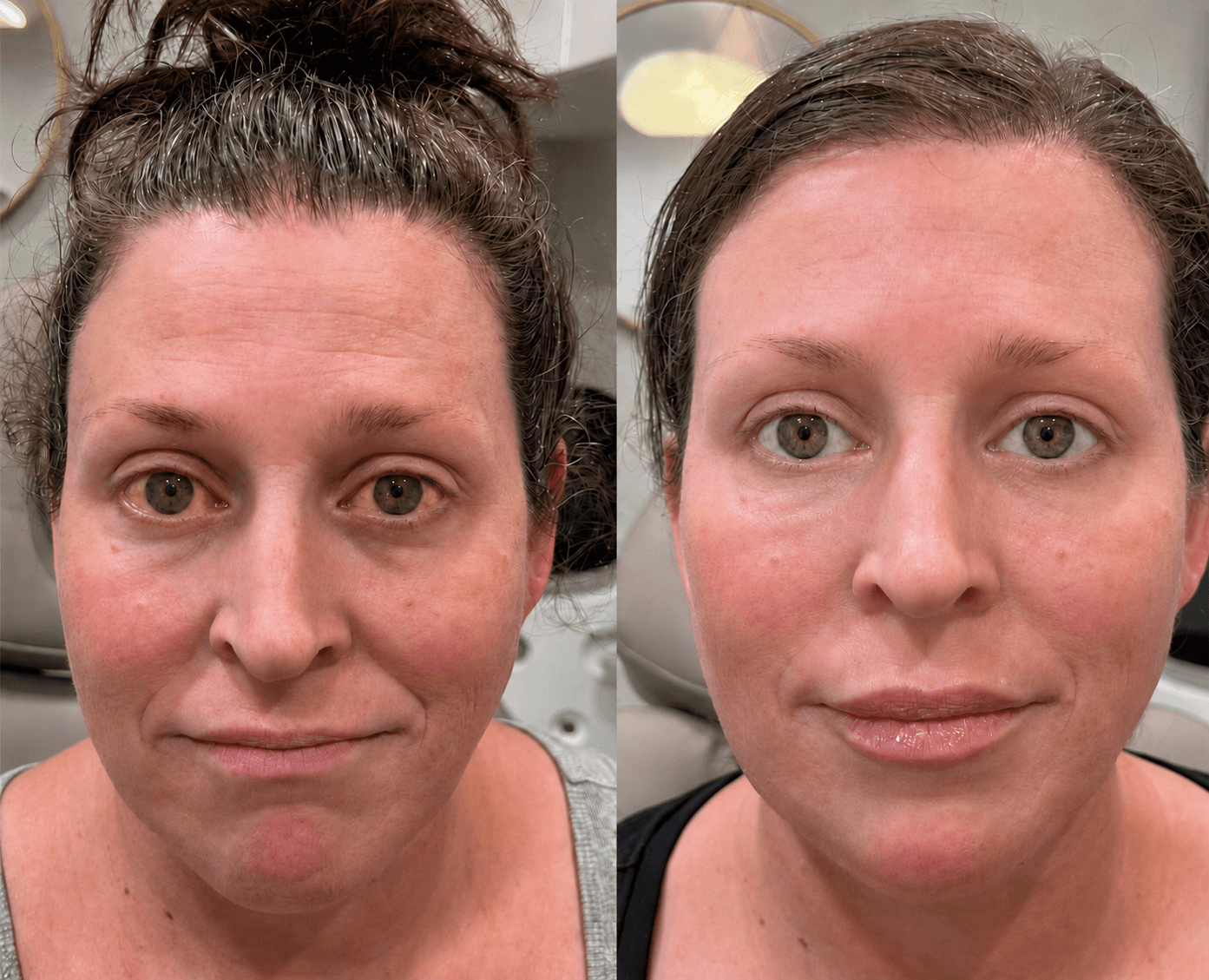 Lunaramint™ Vision Comfort Eye Patches