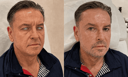 Lunaramint™ Vision Comfort Eye Patches