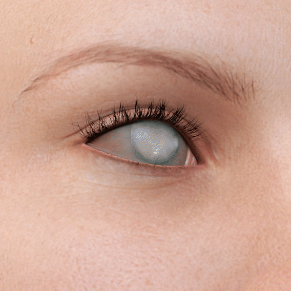 Lunaramint™ Vision Comfort Eye Patches