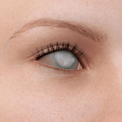 Lunaramint™ Vision Comfort Eye Patches