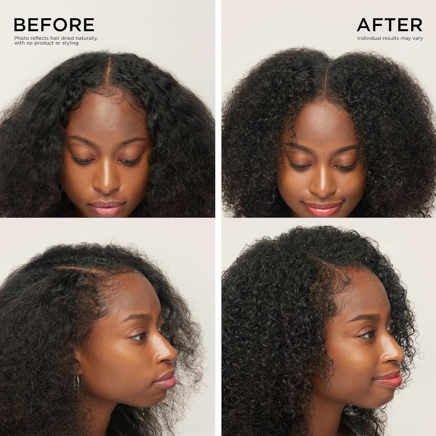 VELLUNEXA™ Precision Scalp Roll-On Serum for Fuller-Looking Hair