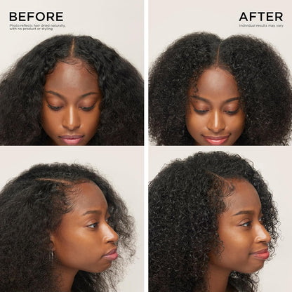 VELLUNEXA™ Precision Scalp Roll-On Serum for Fuller-Looking Hair