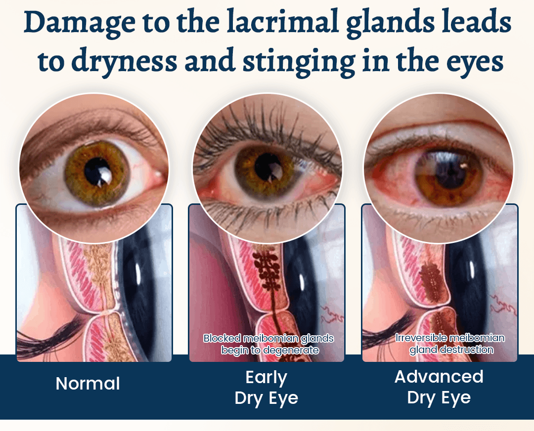 Lunaramint™ Vision Comfort Eye Patches