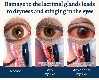 Lunaramint™ Vision Comfort Eye Patches