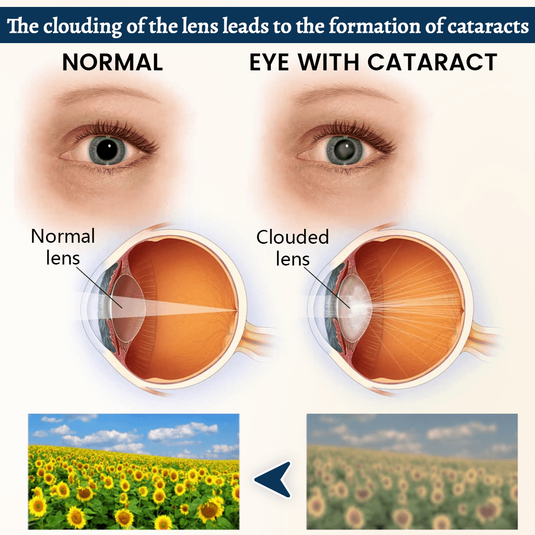 Lunaramint™ Vision Comfort Eye Patches