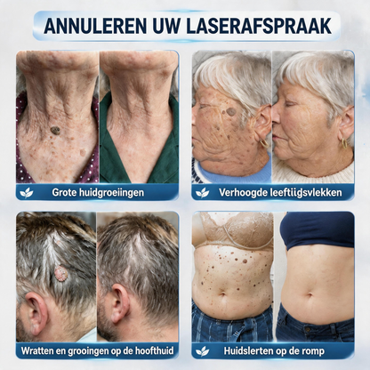 🔥Officiële merkshop | 🖊️Oryvessa™ 7-daagse wratten- en vlekkenverwijderaar (pijnstillende applicator voor nauwkeurig aanbrengen, laat geen littekens achter)